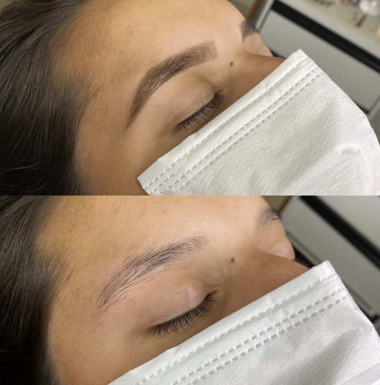 Antes e depois de brow lamination alinhando os fios da sobrancelha